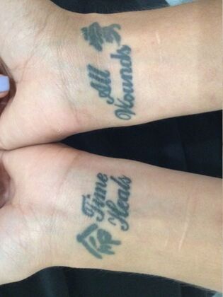 Laser Tattoo Removal Case 16 - Before