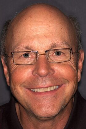 Veneers Dave - Before