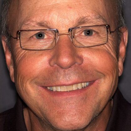 Smile Makeover Dave - Before