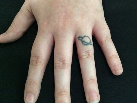 Laser Tattoo Removal Case 28 - Before