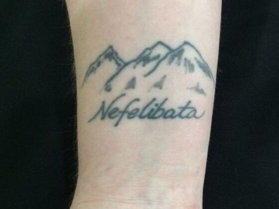 Laser Tattoo Removal Case 30 - Before