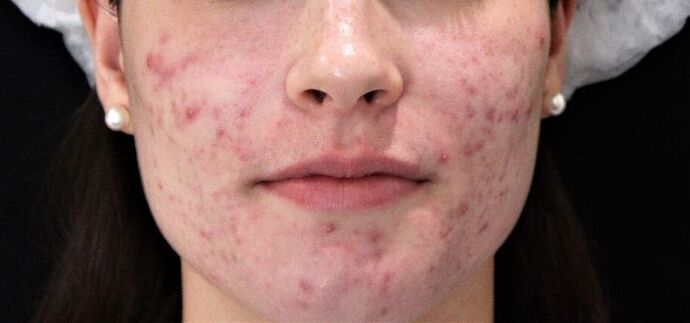 Skin Treatments Case 3 - Before