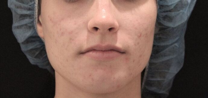 Skin Treatments Case 3 - After