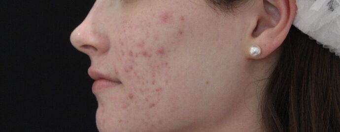 Skin Treatments: Case 3 - Before