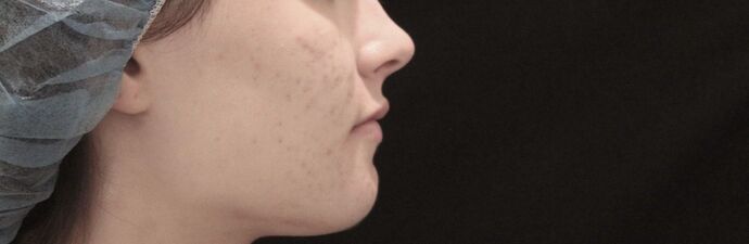 Skin Treatments: Case 3 - After