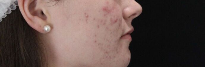 Skin Treatments: Case 3 - Before