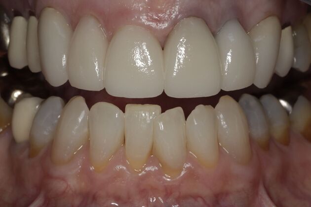 Cosmetic Dentistry Case 10 - After