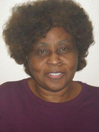 Invisalign: Case 16 - Before