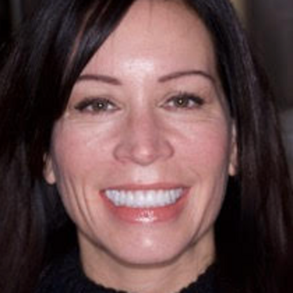 Dental Implants Laura - After