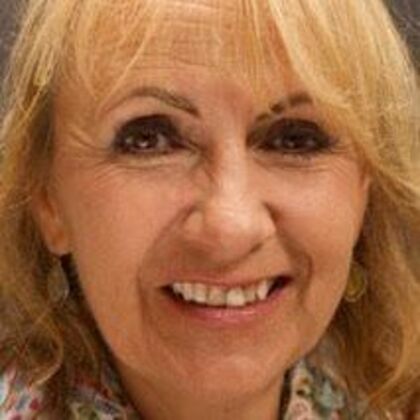 Smile Makeover Lisa - Before