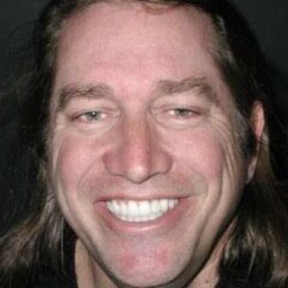 Dental Implants: Steve - After