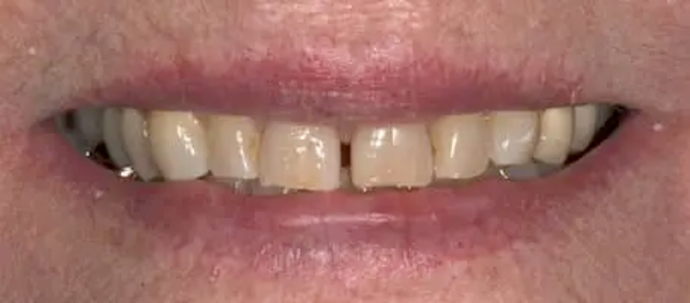 Crowns: Margo - Before