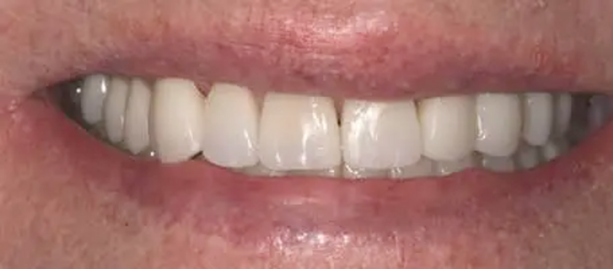 Crowns: Margo - After