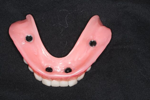 Dentures Case 19 - After