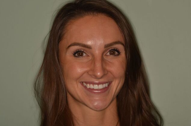 Composite Bonding Case 10 - Before