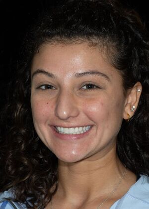 Porcelain Veneers: CH - After