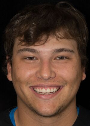 Porcelain Veneers: JG - After