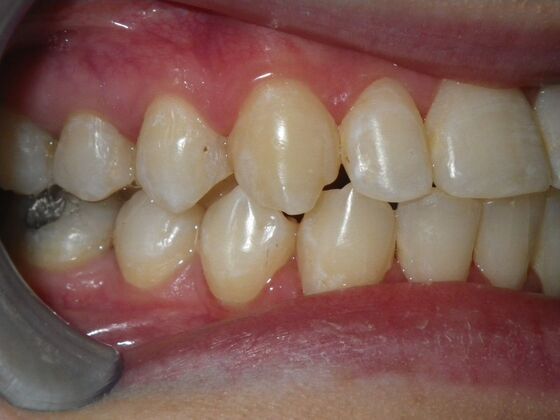 Orthodontics: Case 1 - After