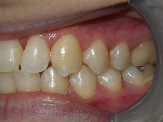 Orthodontics: Case 1 - After