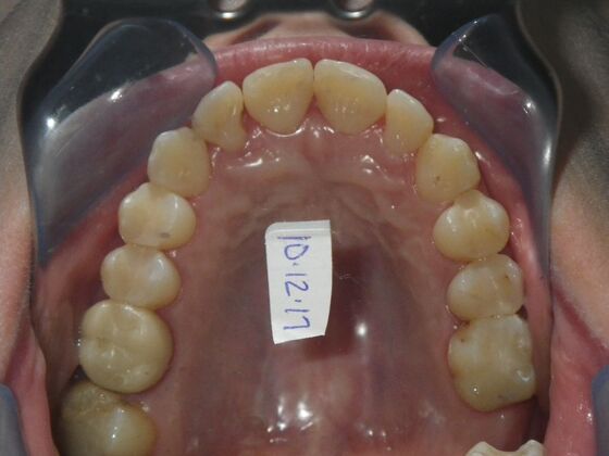 Orthodontics: Case 1 - After