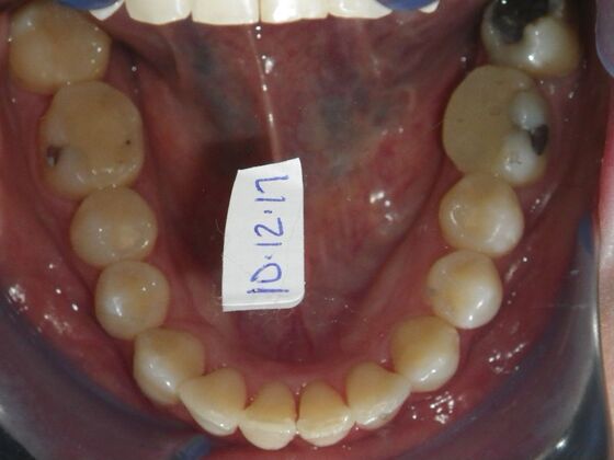 Orthodontics: Case 1 - After