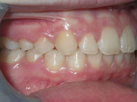 Orthodontics: Case 2 - After