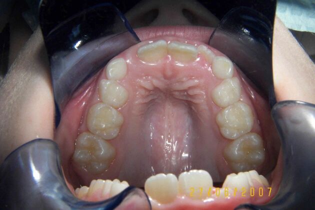 Orthodontics: Case 2 - Before