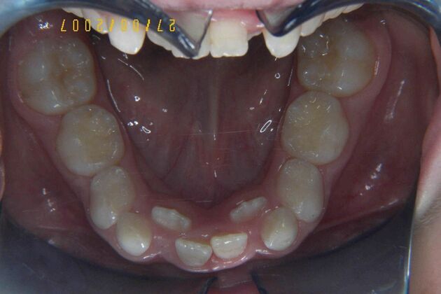 Orthodontics: Case 2 - Before