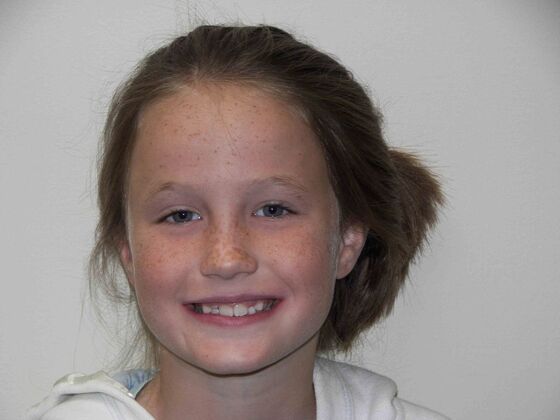 Orthodontics: Case 2 - Before