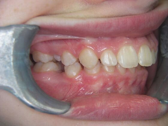 Orthodontics: Case 2 - After