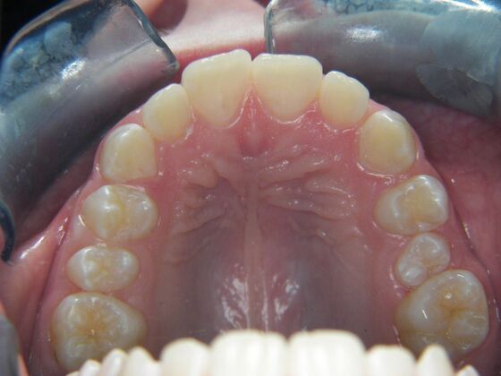 Orthodontics: Case 2 - After