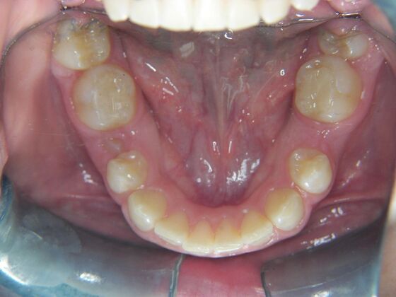 Orthodontics: Case 2 - After