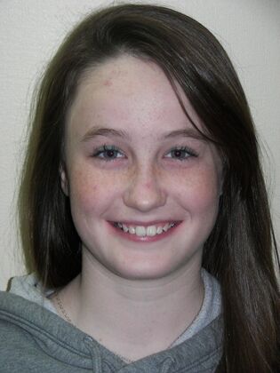 Orthodontics: Case 2 - After