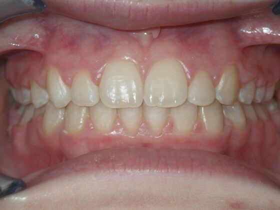 Orthodontics: Case 2 - After