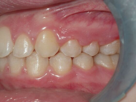 Orthodontics: Case 2 - After