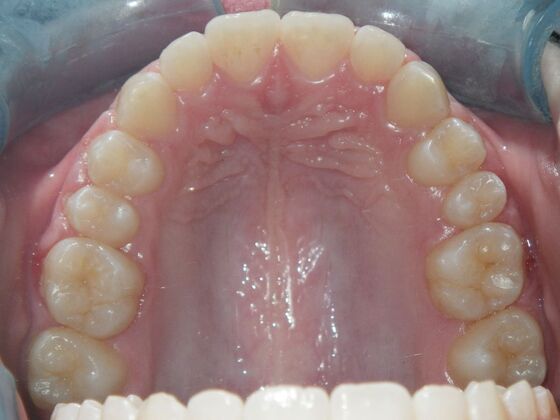Orthodontics: Case 2 - After