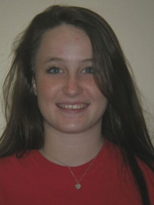 Orthodontics: Case 2 - After