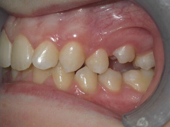 Orthodontics: Case 4 - Before