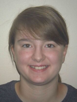 Orthodontics: Case 4 - Before