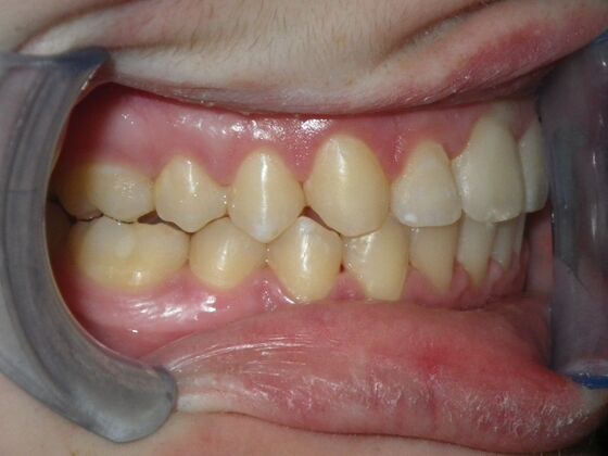 Orthodontics: Case 4 - After