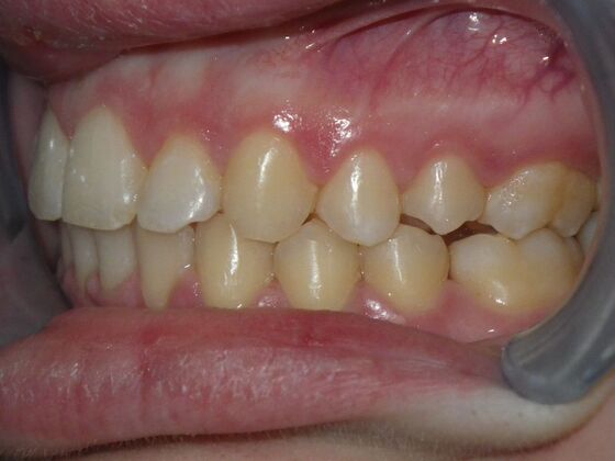 Orthodontics: Case 4 - After