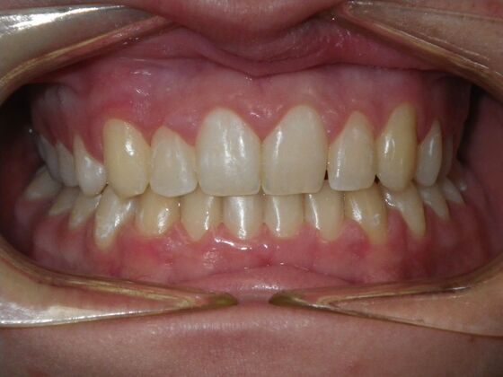 Orthodontics: Case 5 - After
