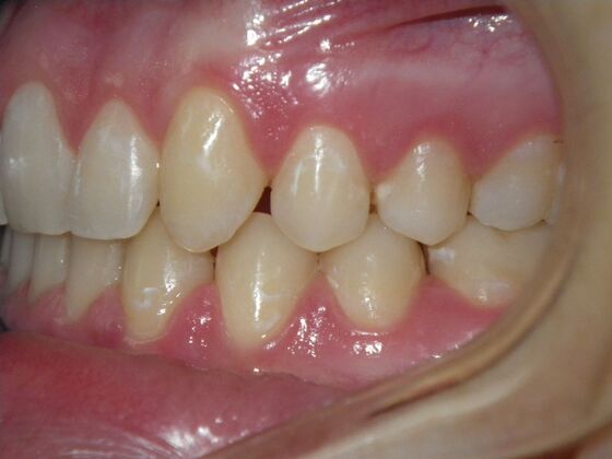 Orthodontics: Case 5 - After