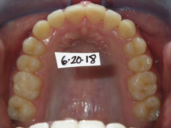 Orthodontics: Case 5 - After