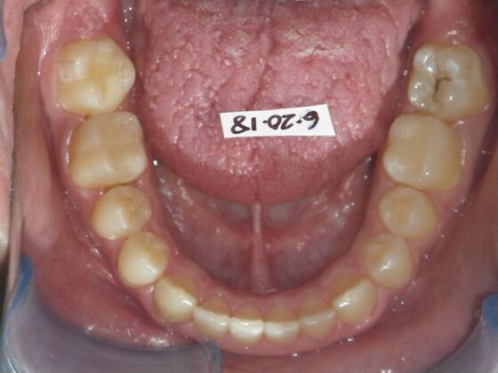 Orthodontics: Case 5 - After