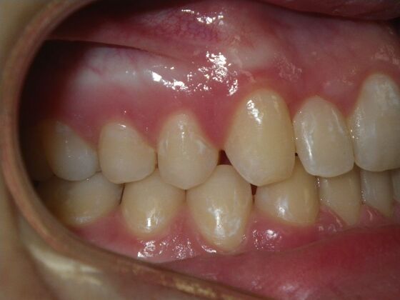 Orthodontics: Case 5 - After