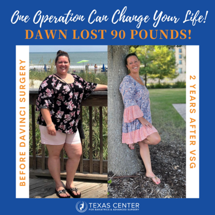 Surgiversary Celebrations Happy 2 Year Surgiversary Dawn!