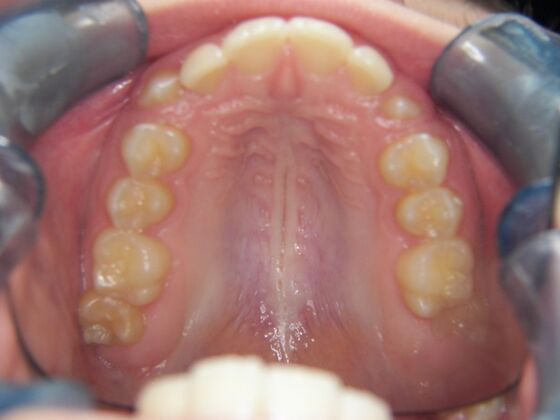 Orthodontics: Case 7 - Before