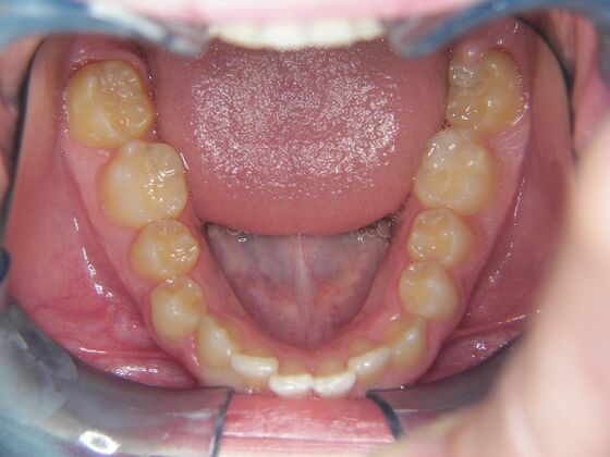 Orthodontics: Case 7 - Before