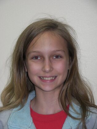 Orthodontics: Case 7 - Before